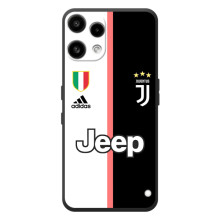 Чехлы для Nothing Phone (3a) Lite (VPrint) - Футбольные клубы (Juventus)