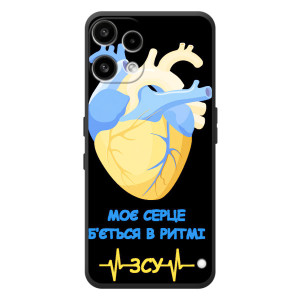 ЗСУ Чехлы (TPU) для Nothing Phone (3a) Lite (Ритм ЗСУ)