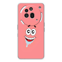 Чохли з Патріком на Nothing Phone (3a) Pro – Мордочка Патріка