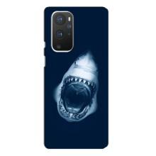 Силиконовый бампер с картинкой животных для OnePlus 9 Pro (Пасть Акулы)