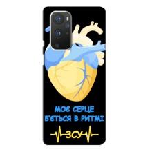 ЗСУ Чехлы (TPU) для OnePlus 9 Pro (Ритм ЗСУ)