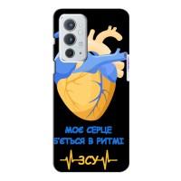 ЗСУ Чехлы (TPU) для OnePlus 9RT (Ритм ЗСУ)