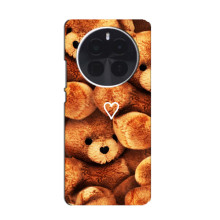 Чохли Мішка Тедді для כשיוпnexus Аце 5 Про – Плюшевий ведмедик