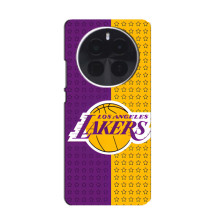 Чехлы с топовыми принтами для 一辆 OnePlus  Асе 5 Про – Лейкерс