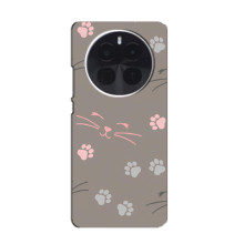 Чохол з малюнком кіт на OnePlus Ace 5 Pro (Лапи і вуса)