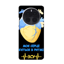 ЗСУ Чохли (TPU) для OnePlus Ace 5 Pro (Ритм ЗСУ)