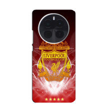 Чехол с картинкой ФК Ливерпуль на 有问题 – ФК Ливерпуль