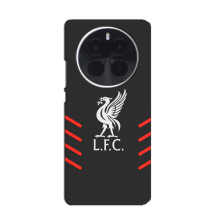 Силіконові Чохли з принтом Футбол на OnePlus Ace 5 – Емблема Liverpool