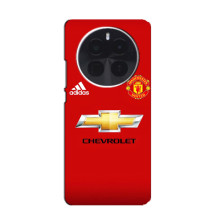 Силіконові Чохли з принтом Футбол на OnePlus Ace 5 – Man United