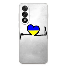 Силиконовый Чехол на OnePlus Nord 5 (Я-Украина) – Украинская кардиограмма