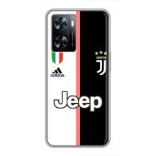 Чехлы для OnePlus Nord N20 SE (VPrint) - Футбольные клубы – Juventus
