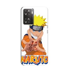 Чехлы с принтом Наруто на OnePlus Nord N20 SE (Naruto)