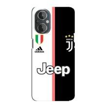Чехлы для OnePlus Nord N20 (VPrint) - Футбольные клубы (Juventus)