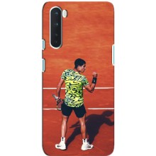 Чехлы с принтом Спортивная тематика для OnePlus Nord – Алькарас Теннисист