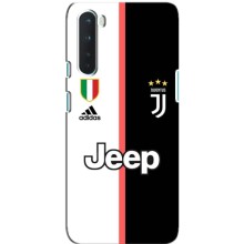 Чохоли з ТОР футбольними клубами на OnePlus Nord (Juventus)