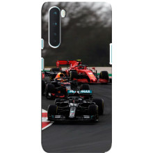 Чохол Формула1 на OnePlus Nord – Гонка Ф1