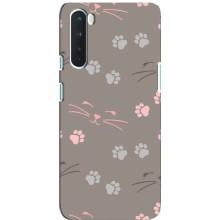 Чохол з малюнком кіт на OnePlus Nord – Лапи і вуса