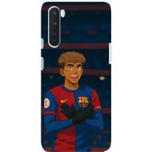 Чехол с футболистом Ламин Ямаль OnePlus Nord – Футболист Ямал