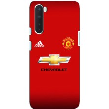 Силиконовые Чехлы принт Футбол на OnePlus Nord (Man United)