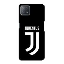 Чехлы для Oppo a72 (5G) (VPrint) - Футбольные клубы (ФК Ювентус)