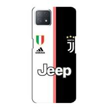 Чехлы для Oppo a72 (5G) (VPrint) - Футбольные клубы (Juventus)