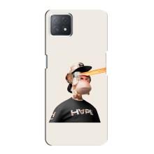 Чехлы с Обезьянами NFT для Oppo a72 (5G) (AlphaPrint) (обезьяна NFT в очках)