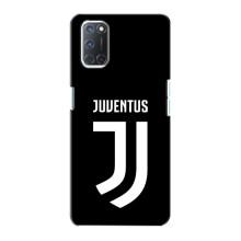 Чохли для Oppo A72 (VPrint) - Футбольні клуби (ФК Ювентус)