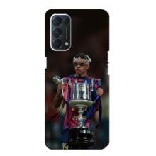 Чехол с футболистом Ламин Ямаль OPPO A74 – Ямал с кубком