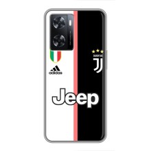 Чехлы для Oppo A77 (VPrint) - Футбольные клубы (Juventus)