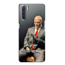 Чохол з картинкою Олександр Усик для Oppo A91 – Усик (Hitman)