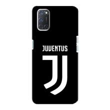 Чехлы для Oppo A92 (VPrint) - Футбольные клубы (ФК Ювентус)