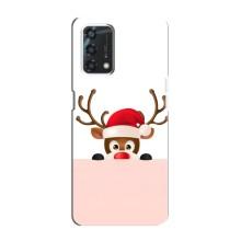 Чехол Санта Клаус для Oppo A95 – Олененок