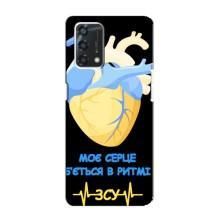 ЗСУ Чехлы (TPU) для Oppo A95 – Ритм ЗСУ
