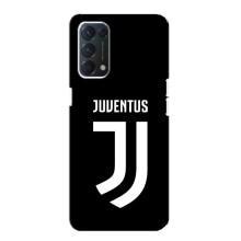 Чохли для Oppo Find X3 Lite (VPrint) - Футбольні клуби (ФК Ювентус)