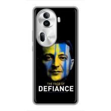 Чехол для Oppo Reno 11 Pro 5G (AlphaPrint - с принтом Зеленского)