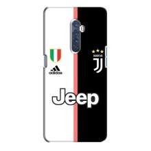 Чохли для Oppo Reno 2 (VPrint) - Футбольні клуби (Juventus)