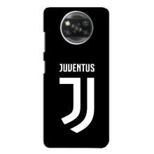 Чохли для Oppo Reno 4 (VPrint) - Футбольні клуби (ФК Ювентус)