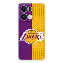 Чехлы с топовыми принтами для Оппо Рено 13 Про (Лейкерс)