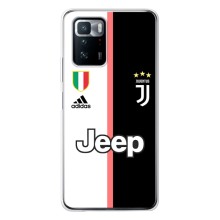 Чехлы для Xiaomi POCO X3 GT (VPrint) - Футбольные клубы (Juventus)