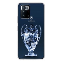 Чехлы для Xiaomi POCO X3 GT (VPrint) - Футбольные клубы (Кубок ЛЧ)