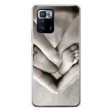 Чохли для МАМИ на Xiaomi POCO X3 GT – Люблячі долоні