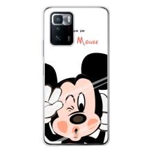 Чехлы для телефонов Xiaomi POCO X3 GT - Дисней – Mickey Mouse