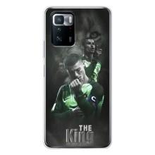 Чехол Криштиану Роналду для Xiaomi POCO X3 GT (AlphaPrint) (Криштиано Лев)