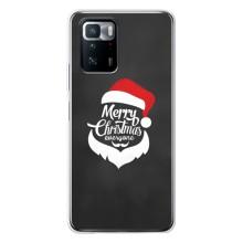 Чехол Санта Клаус для Xiaomi POCO X3 GT – Санта Крисмас