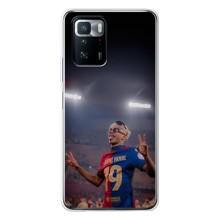 Чехол с футболистом Ламин Ямаль Xiaomi POCO X3 GT – Ямаль на стадионе