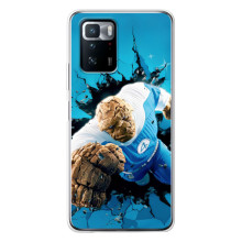 Чехол с принтом Фантастическая четверка для Xiaomi POCO X3 GT – Существо