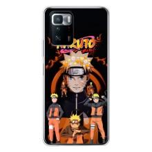 Naruto Anime Чехлы для Поко X3 GT (AlphaPrint)