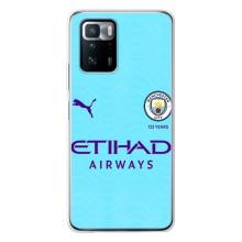 Силіконові Чохли з принтом Футбол на Xiaomi POCO X3 GT – Man City