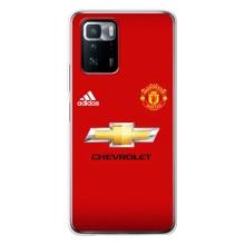 Силіконові Чохли з принтом Футбол на Xiaomi POCO X3 GT – Man United