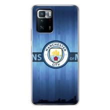 Силіконові Чохли з принтом Футбол на Xiaomi POCO X3 GT – ManCity